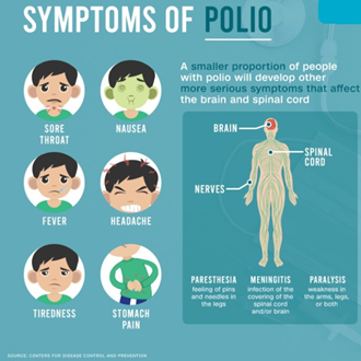 Polio virus in sewage sample in UK - GS SCORE